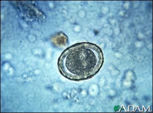 Roundworm eggs – ascariasis